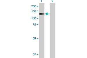 Western Blot analysis of TRPA1 expression in transfected 293T cell line by TRPA1 MaxPab polyclonal antibody.