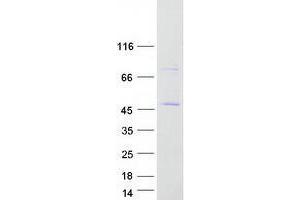 Validation with Western Blot (ZSCAN16 Protein (Myc-DYKDDDDK Tag))