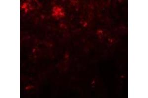 Immunofluorescence of NANOG in Human Spleen cells with NANOG antibody at 20 µg/ml. (Nanog antibody  (Center))