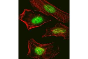 Fluorescent confocal image of Hela cell stained with Pan SUMO Antibody (ABIN388089 and ABIN2846043). (Pan SUMO antibody)