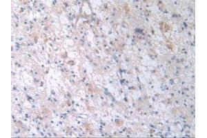 Figure. (TTR antibody  (AA 21-147))