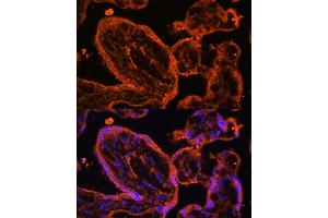 Immunofluorescence analysis of human placenta cells using LDB3 antibody (ABIN6128179, ABIN6143125, ABIN6143126 and ABIN6223347) at dilution of 1:100. (LIM Domain Binding 3 Protein antibody  (AA 1-283))