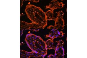 Immunofluorescence analysis of human placenta cells using LDB3 antibody (ABIN6128179, ABIN6143125, ABIN6143126 and ABIN6223347) at dilution of 1:100. (LIM Domain Binding 3 Protein antibody  (AA 1-283))