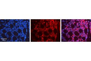 Rabbit Anti-FOS Antibody   Formalin Fixed Paraffin Embedded Tissue: Human Bone Marrow Tissue Observed Staining: Nucleus, Cytoplasm Primary Antibody Concentration: 1:600 Other Working Concentrations: N/A Secondary Antibody: Donkey anti-Rabbit-Cy3 Secondary Antibody Concentration: 1:200 Magnification: 20X Exposure Time: 0. (c-FOS antibody  (Middle Region))