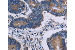 Immunohistochemistry (IHC) image for anti-IL2-Inducible T-Cell Kinase (ITK) antibody (ABIN2430324)
