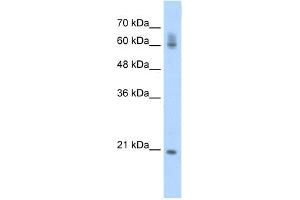 WB Suggested Anti-FIP1L1 Antibody Titration:  0. (FIP1L1 antibody  (C-Term))