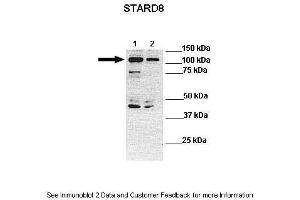 Lanes:  Lane 1: 30ug human HLE lysate Lane 2: 30ug human PLC/PRF-5 lysate  Primary Antibody Dilution:  1:1000 Secondary Antibody:  Anti-rabbit-HRP Anti-rabbit-HRP Secondary Antibody Dilution:  1:10,000 Gene Name:  STARD8 Submitted by:  Dr Frankie Ko Chi Fat, Lo-Kong Chan, Irene O. (STARD8 antibody  (N-Term))
