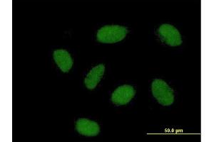 Immunofluorescence of purified MaxPab antibody to FLJ38964 on HeLa cell. (REM2 antibody  (AA 1-330))