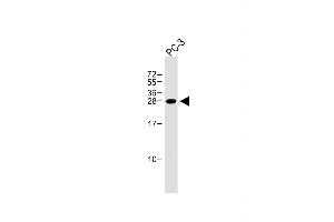 Anti-NDFIP1 Antibody (Center) at 1:1000 dilution + PC-3 whole cell lysate Lysates/proteins at 20 μg per lane. (NDFIP1 antibody  (AA 77-106))