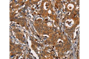 Immunohistochemistry (IHC) image for anti-Carcinoembryonic Antigen-Related Cell Adhesion Molecule 3 (CEACAM3) antibody (ABIN2432095)