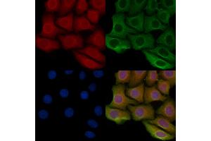 ABIN6259255 and ABIN6275356 staining Hela cells by IF/ICC.