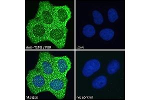 ABIN185697 Immunofluorescence analysis of paraformaldehyde fixed MCF7 cells, permeabilized with 0. (TSPO antibody  (C-Term))
