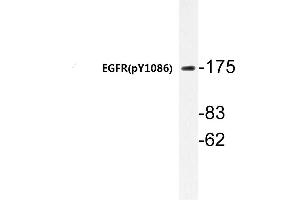 Western blot (WB) analyzes of p-EGFR antibody in extracts from HepG2 cells. (EGFR antibody  (pTyr1110))