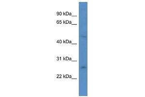 Western Blot showing ANKRD32 antibody used at a concentration of 1.