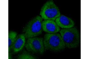 A431 cells were fixed in paraformaldehyde, permeabilized with 0. (KRT16 antibody)
