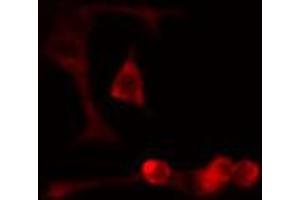 ABIN6274701 staining Hela cells by IF/ICC. (RAD51D antibody  (C-Term))
