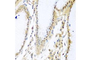 Immunohistochemistry of paraffin-embedded human stomach using MYBBP1A antibody at dilution of 1:100 (40x lens). (MYBBP1A antibody)