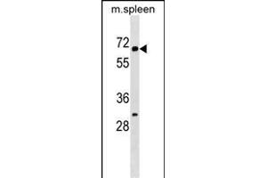 KLH22 Antibody (C-term) (ABIN1537487 and ABIN2849661) western blot analysis in mouse spleen tissue lysates (35 μg/lane). (KLHL22 antibody  (C-Term))