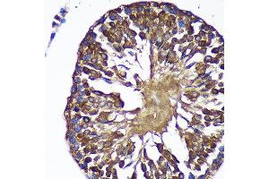 Immunohistochemistry of paraffin-embedded Rat testis using SENP1 Rabbit pAb (ABIN6132646, ABIN6147534, ABIN6147536 and ABIN6216945) at dilution of 1:100 (40x lens). (SENP1 antibody  (AA 220-420))