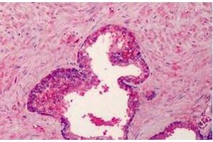 Formalin-Fixed, Paraffin-Embedded Human Placenta stained with BMP4 antibody at 5 µg/ml after heat-induced antigen retrieval. (BMP4 antibody)