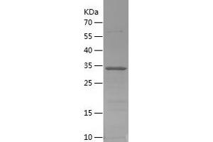Western Blotting (WB) image for Pancreatic Polypeptide (PPY) (AA 1-95) protein (His-IF2DI Tag) (ABIN7283393) (PPY Protein (AA 1-95) (His-IF2DI Tag))