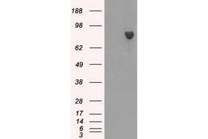 HEK293T cells were transfected with the pCMV6-ENTRY control (Left lane) or pCMV6-ENTRY BTK (Right lane) cDNA for 48 hrs and lysed. (BTK antibody)