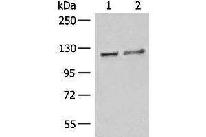 Western blot analysis of K562 cell Human fetal brain tissue lysates using IPO11 Polyclonal Antibody at dilution of 1:500 (Importin 11 antibody)