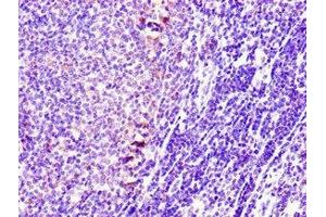 Immunohistochemistry of paraffin-embedded human lymph node tissue using ABIN7170721 at dilution of 1:100 (Stathmin 1 antibody  (AA 13-78))