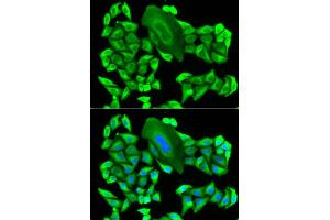 Immunofluorescence analysis of HeLa cell using MTAP antibody. (MTAP antibody)