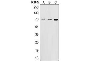 Western blot analysis of CD122 expression in BJAB (A), HuT78 (B), CTLL2 (C) whole cell lysates. (IL2 Receptor beta antibody  (N-Term))