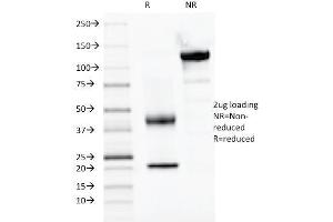 SDS-PAGE Analysis Purified PAX2, Monoclonal Antibody (PAX2/1104). (PAX2A antibody  (AA 223-354))