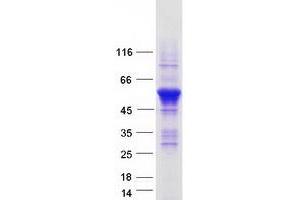 Validation with Western Blot (RUFY3 Protein (Transcript Variant 2) (Myc-DYKDDDDK Tag))