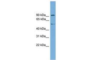 Image no. 1 for anti-Nuclear Receptor Subfamily 4, Group A, Member 3 (NR4A3) (AA 503-552) antibody (ABIN6744907) (NR4A3 antibody  (AA 503-552))