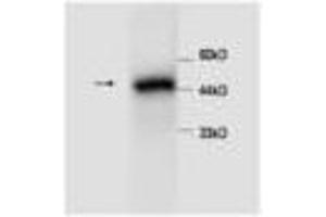 Image no. 1 for anti-serpin Peptidase Inhibitor, Clade A (Alpha-1 Antiproteinase, Antitrypsin), Member 1 (SERPINA1) (AA 25-418) antibody (ABIN791494)