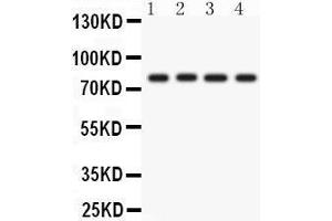 Western Blotting (WB) image for anti-Protein Kinase C, eta (PRKCH) (AA 30-389) antibody (ABIN3043361) (PKC eta antibody  (AA 30-389))