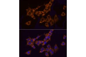 Immunofluorescence analysis of PC-12 cells using Bag1 Rabbit mAb (ABIN7265847) at dilution of 1:50 (40x lens). (BAG1 antibody)