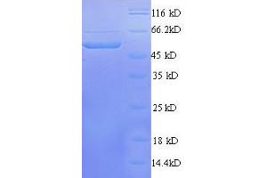 Calcium/calmodulin-Dependent Protein Kinase IV (CAMK4) (AA 1-474) protein (His tag) expressed in E. (CAMK4 Protein (AA 1-474) (His tag))