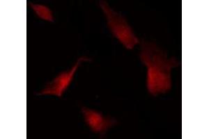 ABIN6269351 staining Hela by IF/ICC. (eIF4EBP1 antibody  (Internal Region))