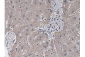 Detection of RAB37 in Human Liver Tissue using Polyclonal Antibody to RAB37, Member RAS Oncogene Family (RAB37)