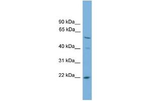 WB Suggested Anti-UBE2T Antibody Titration: 0. (Ube2t antibody  (N-Term))