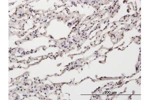 Immunoperoxidase of purified MaxPab antibody to NT5C on formalin-fixed paraffin-embedded human lung. (NT5C antibody  (AA 1-117))