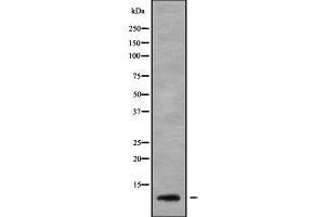 Western blot analysis SERP1 using MCF7 whole cell lysates (SERP1 antibody  (Internal Region))