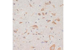 Immunohistochemistry of paraffin-embedded mouse spinal cord using  antibody (ABIN6129209, ABIN6137382, ABIN6137383 and ABIN6219595) at dilution of 1:100 (40x lens). (AXIN2 antibody  (AA 650-750))