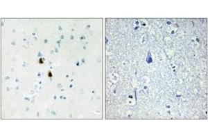 Immunohistochemistry analysis of paraffin-embedded human brain tissue, using IPKA Antibody. (PKIA antibody  (AA 10-59))