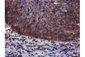 Image no. 1 for anti-PIH1 Domain Containing 2 (PIH1D2) (AA 1-315) antibody (ABIN1490740) (PIH1D2 antibody  (AA 1-315))