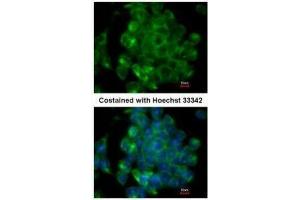 ICC/IF Image Immunofluorescence analysis of methanol-fixed mouse ESC, using SIPA1, antibody at 1:200 dilution. (SIPA1 antibody  (C-Term))