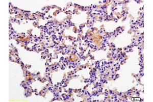 Formalin-fixed and paraffin embedded mouse lung labeled with Rabbit Anti CD69/CLEC2C/AIM Polyclonal Antibody, Unconjugated (ABIN741150) at 1:200 followed by conjugation to the secondary antibody and DAB staining (CD69 antibody  (AA 101-199))