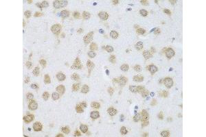 Immunohistochemistry of paraffin-embedded Mouse brain using GRPEL2 Polyclonal Antibody at dilution of 1:100 (40x lens).