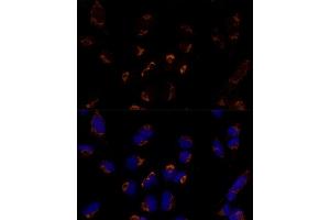 Immunofluorescence analysis of U-2 OS cells using MTCH2 Polyclonal Antibody  at dilution of 1:100 (40x lens). (MTCH2 antibody  (AA 30-175))