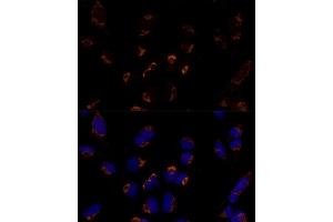 Immunofluorescence analysis of U-2 OS cells using MTCH2 Polyclonal Antibody  at dilution of 1:100 (40x lens). (MTCH2 antibody  (AA 30-175))